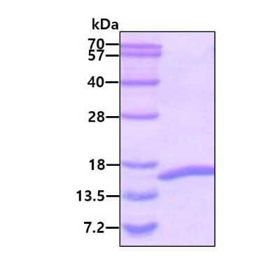 SDS-PAGE: Recombinant Human CEBP alpha His Protein [NBC1-18419]